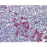 Immunohistochemistry - beta-Amyloid antibody from Signalway Antibody (22965) - Antibodies.com
