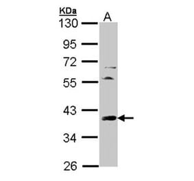 TFIID (SI-1) antibody from Signalway Antibody (23073) - Antibodies.com