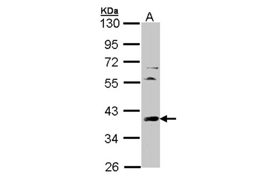TFIID (SI-1) antibody from Signalway Antibody (23073) - Antibodies.com