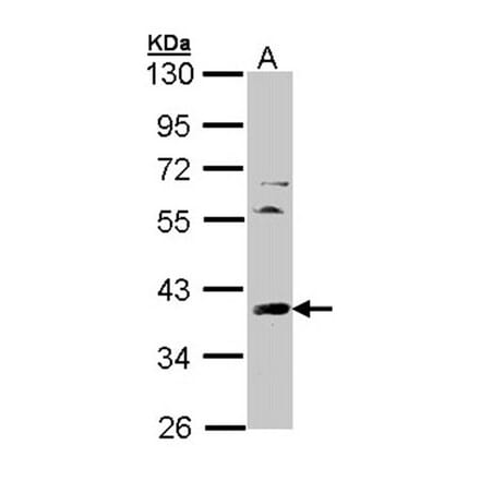 TFIID (SI-1) antibody from Signalway Antibody (23073) - Antibodies.com