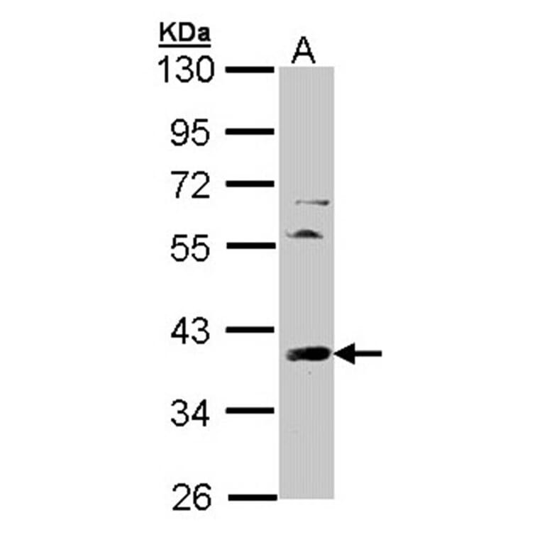 TFIID (SI-1) antibody from Signalway Antibody (23073) - Antibodies.com