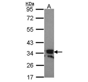 RANKL (CD254) antibody from Signalway Antibody (23087) - Antibodies.com