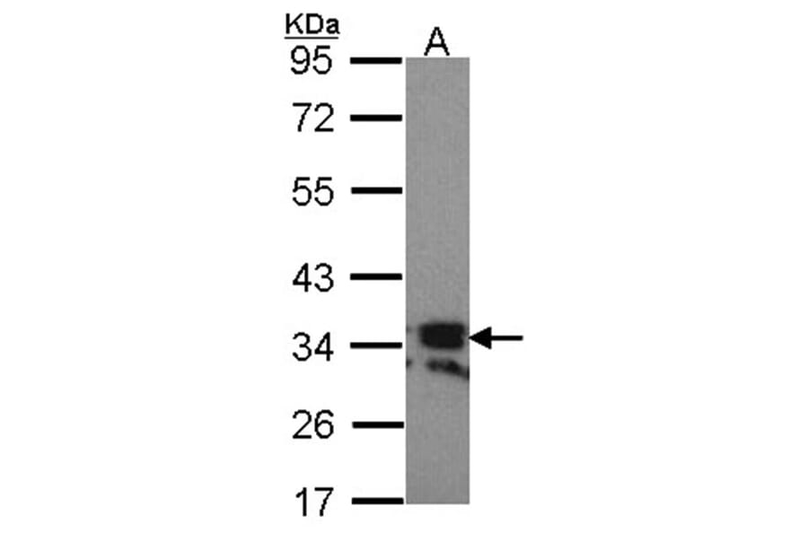 RANKL (CD254) antibody from Signalway Antibody (23087) - Antibodies.com