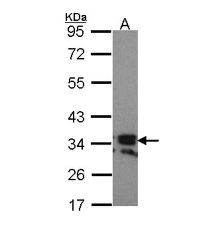 RANKL (CD254) antibody from Signalway Antibody (23087) - Antibodies.com