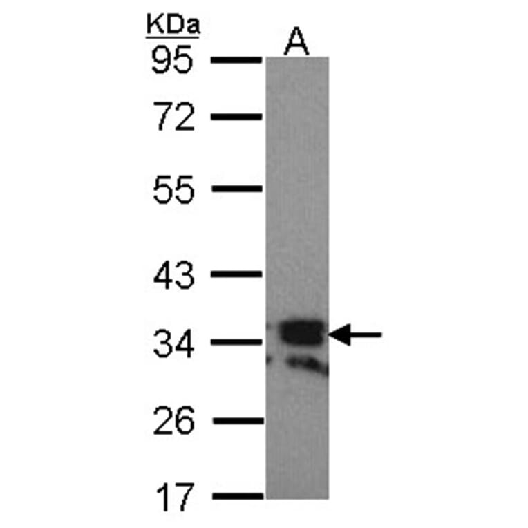 RANKL (CD254) antibody from Signalway Antibody (23087) - Antibodies.com