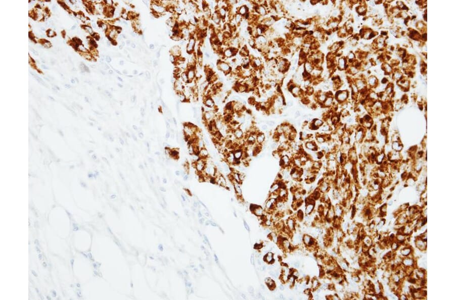 Immunohistochemistry - RANKL (CD254) antibody from Signalway Antibody (23087) - Antibodies.com