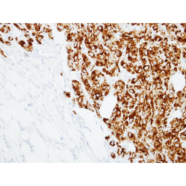 Immunohistochemistry - RANKL (CD254) antibody from Signalway Antibody (23087) - Antibodies.com