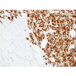 Immunohistochemistry - RANKL (CD254) antibody from Signalway Antibody (23087) - Antibodies.com