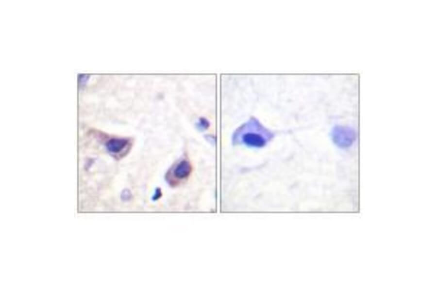 Immunohistochemistry - JAK3 (Ab-785) Antibody from Signalway Antibody (33170) - Antibodies.com