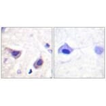 Immunohistochemistry - JAK3 (Ab-785) Antibody from Signalway Antibody (33170) - Antibodies.com