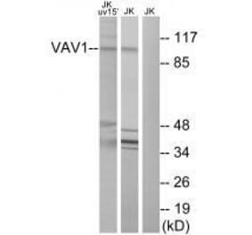 Western blot - VAV1 (Ab-174) Antibody from Signalway Antibody (33208) - Antibodies.com