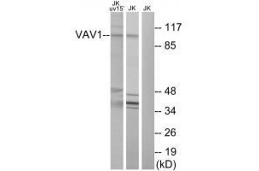 Western blot - VAV1 (Ab-174) Antibody from Signalway Antibody (33208) - Antibodies.com