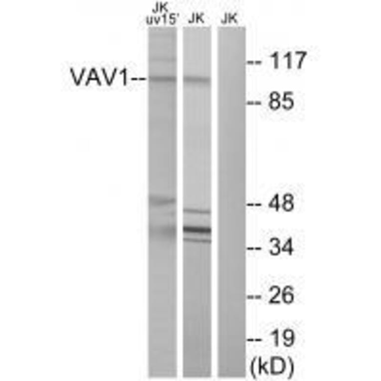 Western blot - VAV1 (Ab-174) Antibody from Signalway Antibody (33208) - Antibodies.com