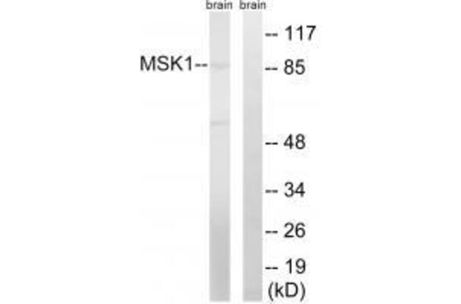 Western blot - MSK1 (Ab-212) Antibody from Signalway Antibody (33238) - Antibodies.com