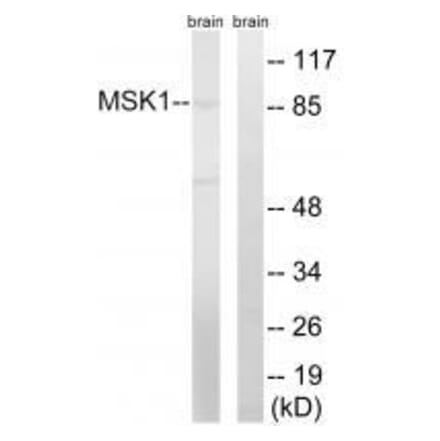 Western blot - MSK1 (Ab-212) Antibody from Signalway Antibody (33238) - Antibodies.com
