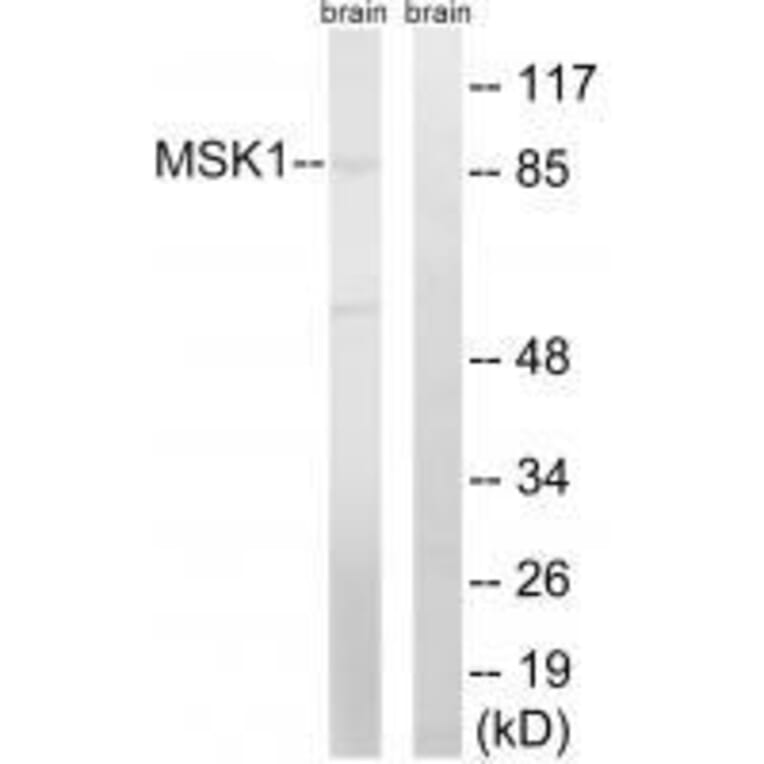 Western blot - MSK1 (Ab-212) Antibody from Signalway Antibody (33238) - Antibodies.com