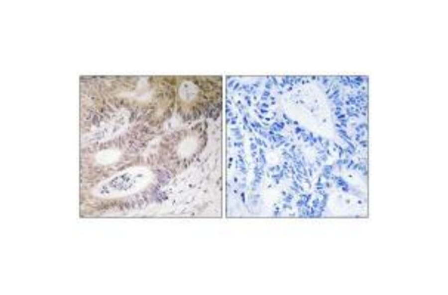 Immunohistochemistry - MSK1 (Ab-212) Antibody from Signalway Antibody (33238) - Antibodies.com