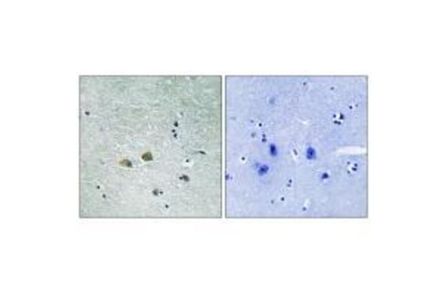 Immunohistochemistry - PAK1 (Ab-204) Antibody from Signalway Antibody (33241) - Antibodies.com
