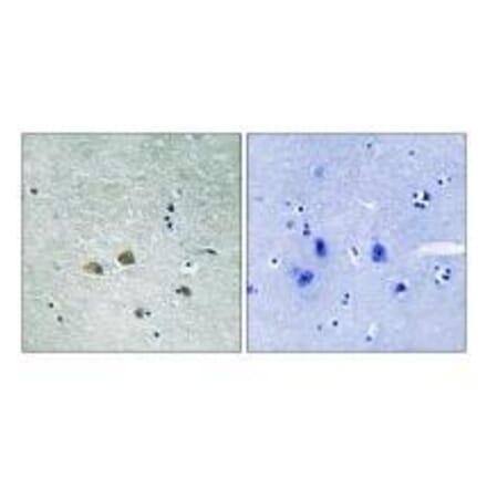 Immunohistochemistry - PAK1 (Ab-204) Antibody from Signalway Antibody (33241) - Antibodies.com