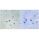 Immunohistochemistry - PAK1 (Ab-204) Antibody from Signalway Antibody (33241) - Antibodies.com