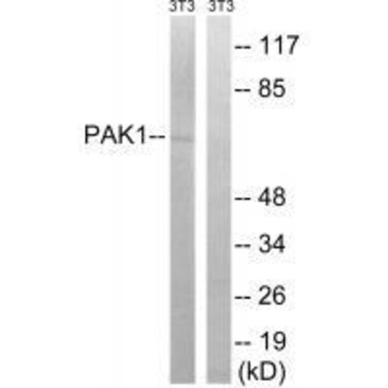 Western blot - PAK1 (Ab-204) Antibody from Signalway Antibody (33241) - Antibodies.com