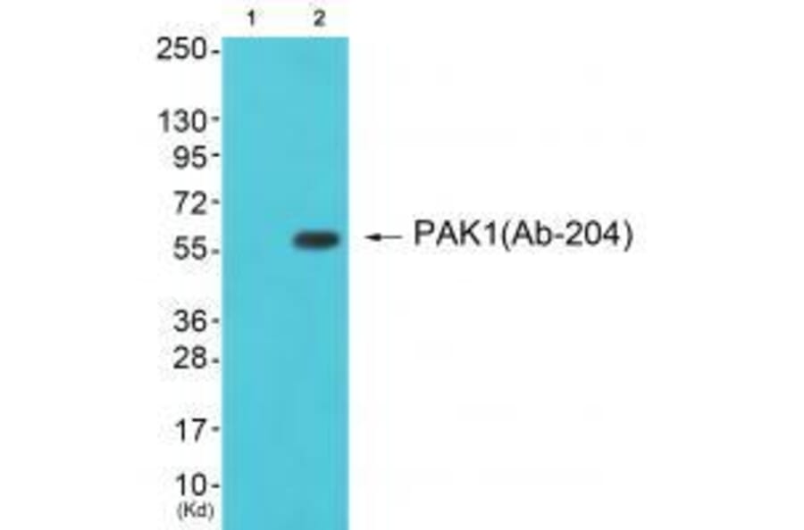 Western blot - PAK1 (Ab-204) Antibody from Signalway Antibody (33241) - Antibodies.com