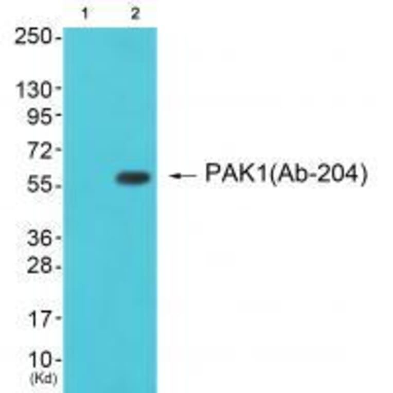 Western blot - PAK1 (Ab-204) Antibody from Signalway Antibody (33241) - Antibodies.com