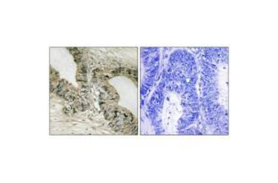 Immunohistochemistry - GRB2 (Ab-159) Antibody from Signalway Antibody (33262) - Antibodies.com