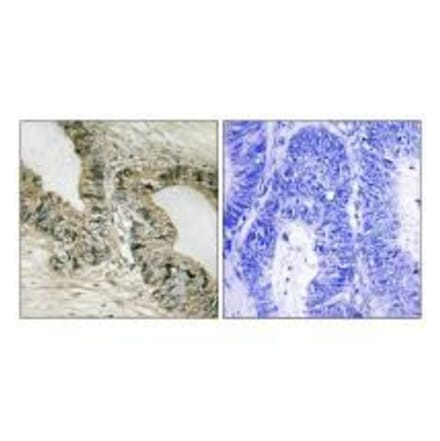 Immunohistochemistry - GRB2 (Ab-159) Antibody from Signalway Antibody (33262) - Antibodies.com
