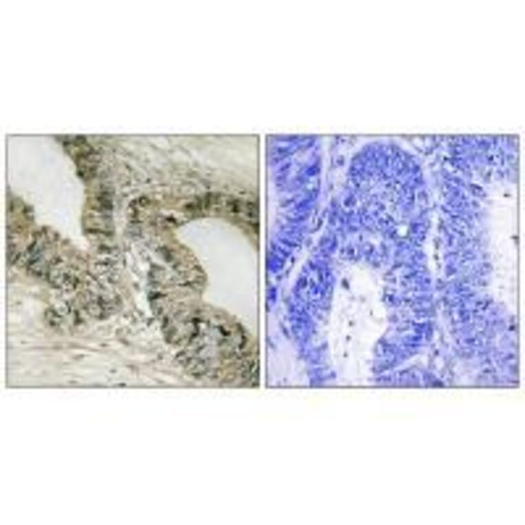 Immunohistochemistry - GRB2 (Ab-159) Antibody from Signalway Antibody (33262) - Antibodies.com