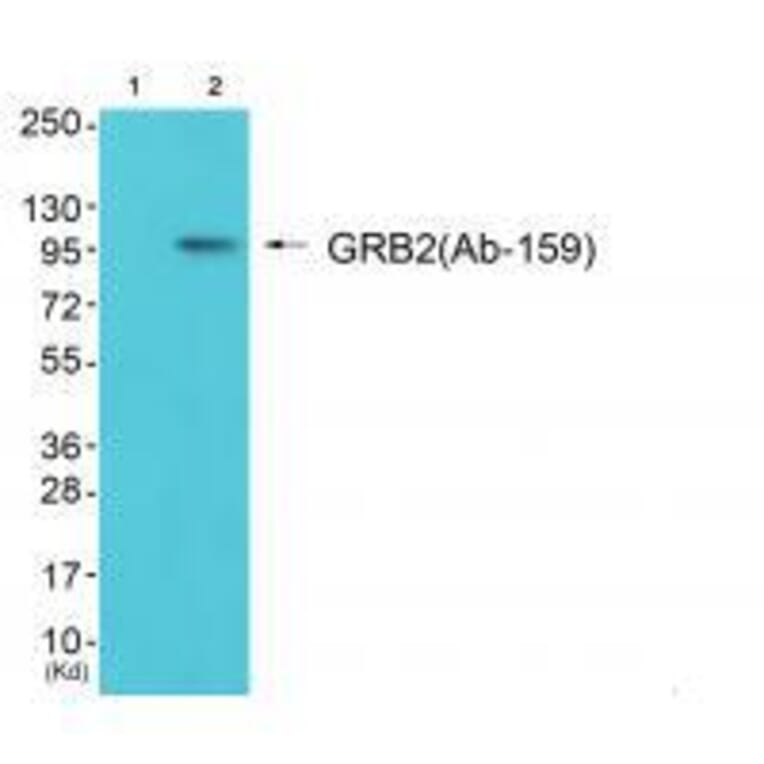 Western blot - GRB2 (Ab-159) Antibody from Signalway Antibody (33262) - Antibodies.com