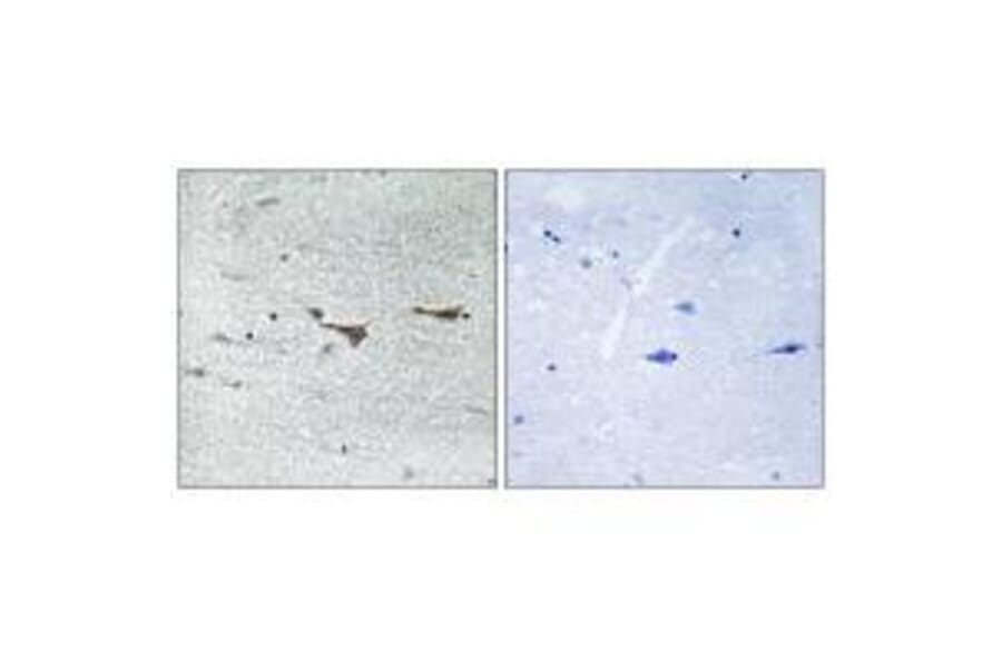 Immunohistochemistry - TOB1 (Ab-164) Antibody from Signalway Antibody (33296) - Antibodies.com