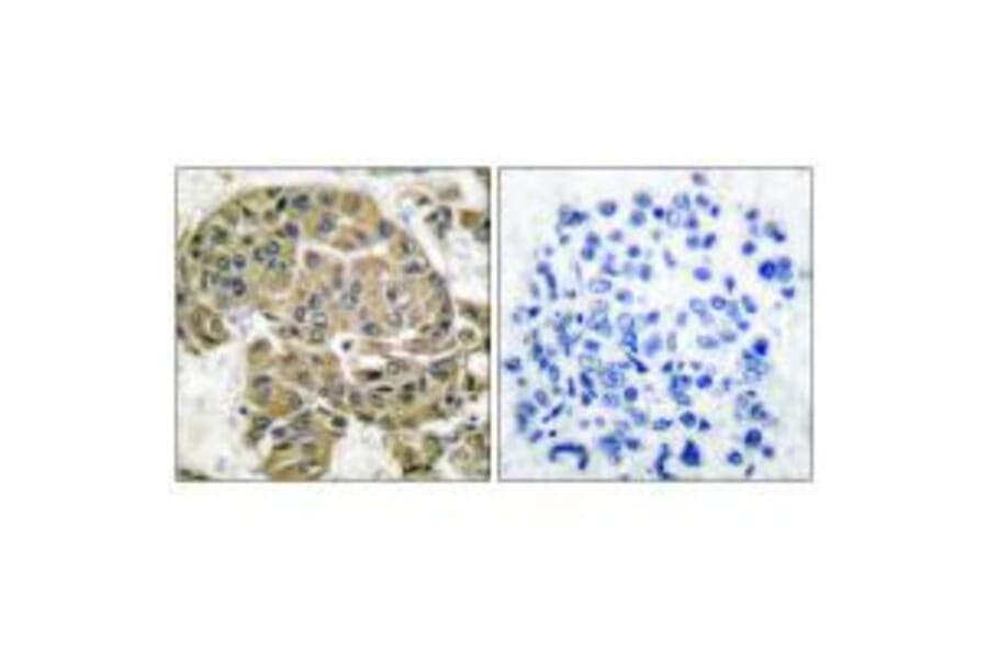 Immunohistochemistry - Mammaglobin B Antibody from Signalway Antibody (33428) - Antibodies.com