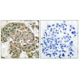 Immunohistochemistry - Mammaglobin B Antibody from Signalway Antibody (33428) - Antibodies.com