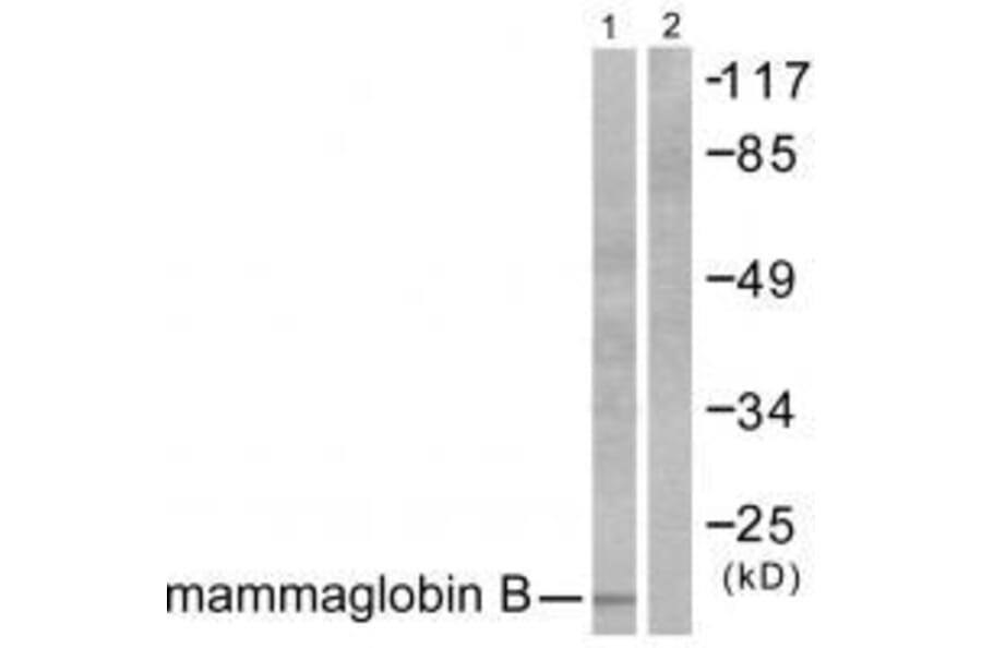 Western blot - Mammaglobin B Antibody from Signalway Antibody (33428) - Antibodies.com