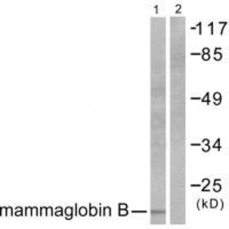 Western blot - Mammaglobin B Antibody from Signalway Antibody (33428) - Antibodies.com
