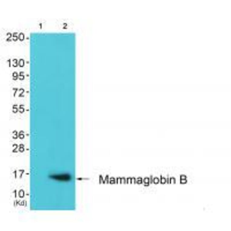 Western blot - Mammaglobin B Antibody from Signalway Antibody (33428) - Antibodies.com