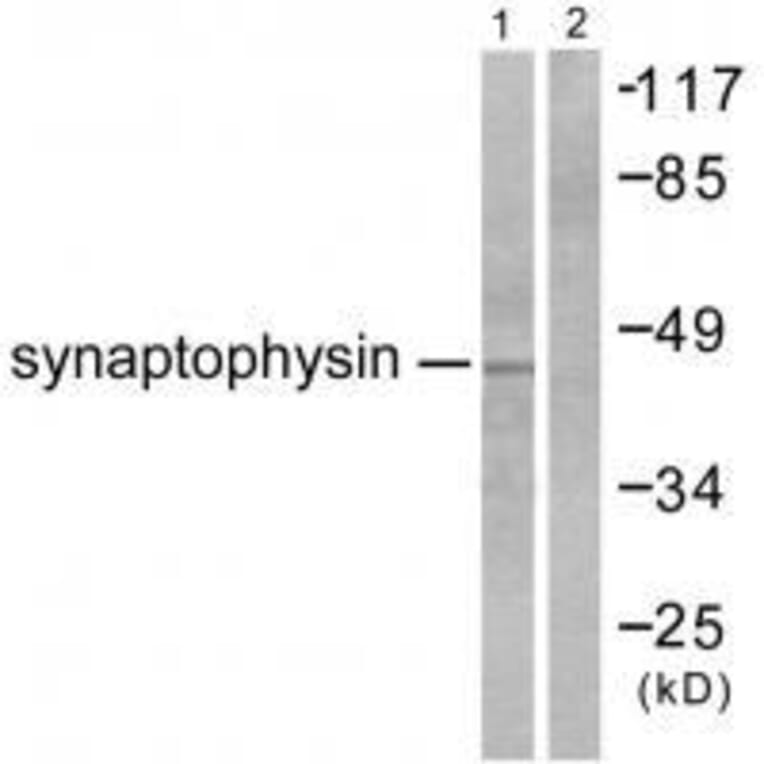 Western blot - Synaptophysin Antibody from Signalway Antibody (33492) - Antibodies.com