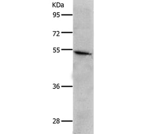 CKMT1A/CKMT1B Antibody from Signalway Antibody (36996) - Antibodies.com