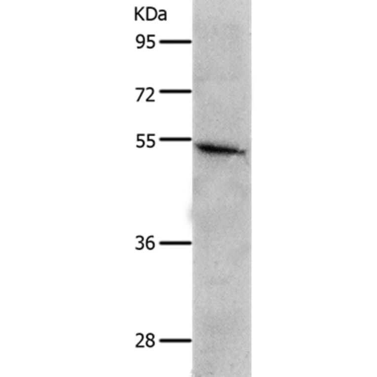 CKMT1A/CKMT1B Antibody from Signalway Antibody (36996) - Antibodies.com