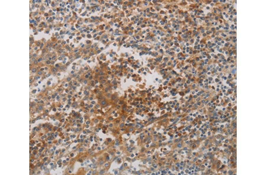 Immunohistochemistry - CKMT1A/CKMT1B Antibody from Signalway Antibody (36996) - Antibodies.com