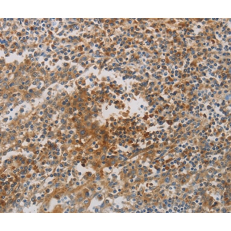 Immunohistochemistry - CKMT1A/CKMT1B Antibody from Signalway Antibody (36996) - Antibodies.com