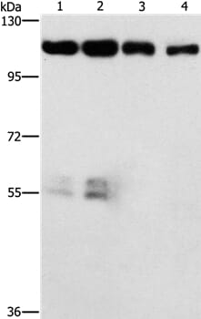 Gel: 6%SDS-PAGE Lysates (from left to right): Hela and hepG2 cell, lovo cell and human colon cancer tissue Amount of lysate: 40ug per lane Primary antibody: 1/750 dilution Secondary antibody dilution: 1/8000 Exposure time: 1 minute