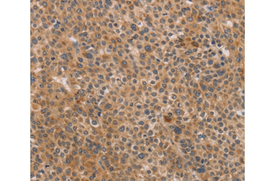Immunohistochemistry - CDK11A/CDK11B Antibody from Signalway Antibody (37479) - Antibodies.com