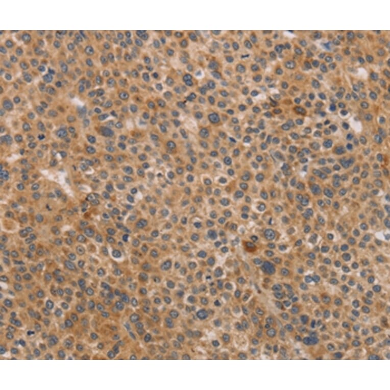 Immunohistochemistry - CDK11A/CDK11B Antibody from Signalway Antibody (37479) - Antibodies.com