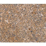 Immunohistochemistry - CDK11A/CDK11B Antibody from Signalway Antibody (37479) - Antibodies.com