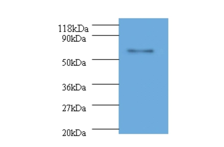 L1 Polyclonal Antibody from Signalway Antibody (42503) - Antibodies.com