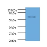 L1 Polyclonal Antibody from Signalway Antibody (42503) - Antibodies.com