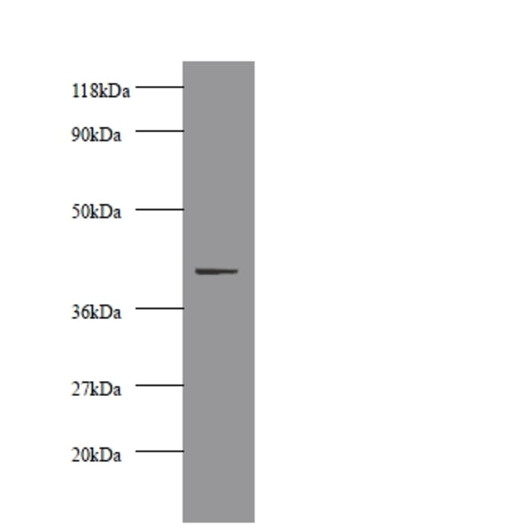 Creatine kinase M-type Polyclonal Antibody from Signalway Antibody (42513) - Antibodies.com