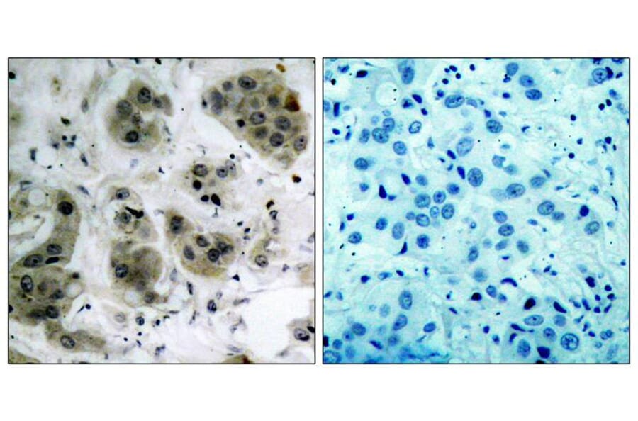 Immunohistochemistry - Akt (Ab-473) Antibody from Signalway Antibody (21054) - Antibodies.com